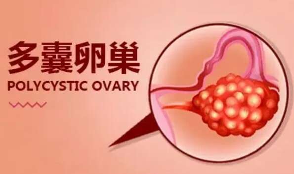 多囊试管促排第七天会排卵吗?常规促排后无效果再试管促排