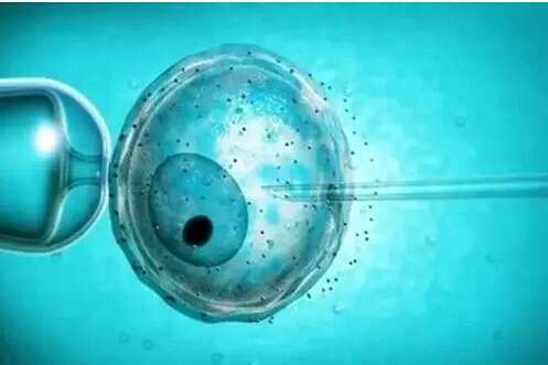 详解第一代第二代第三代第四代试管婴儿的优势与缺点