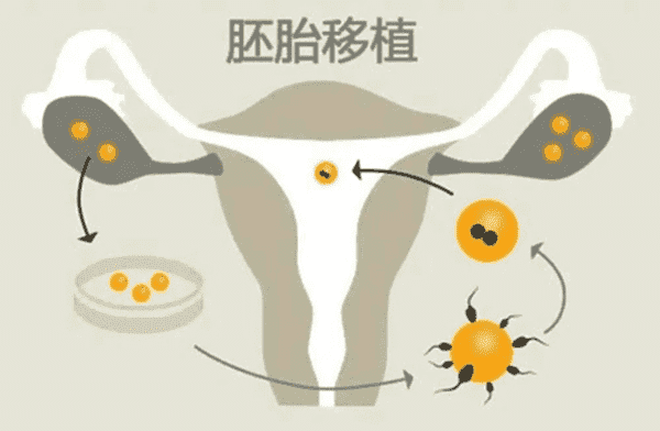 试管婴儿的具体步骤及时间,把握好每一步