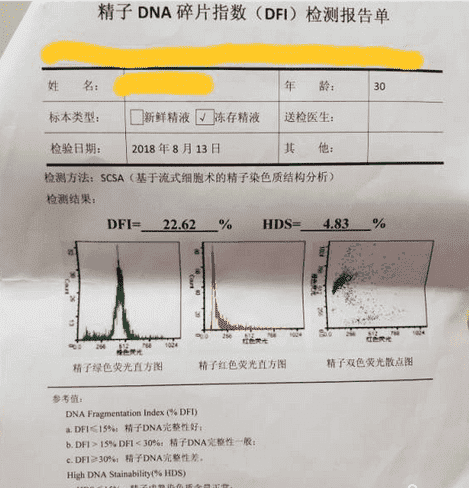 精子碎片指数检查