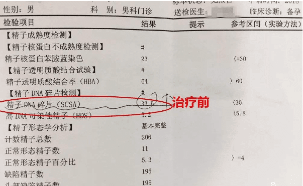 精液检查报告