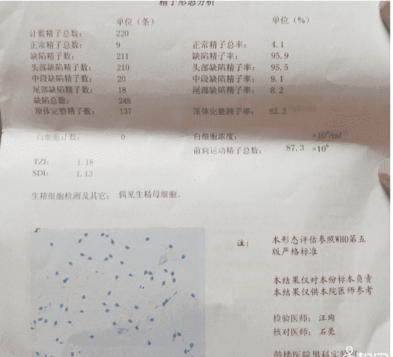 精子碎片检查报告