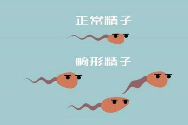 什么是畸形精子