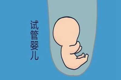 VIP试管婴儿价格，文章带你深度解读