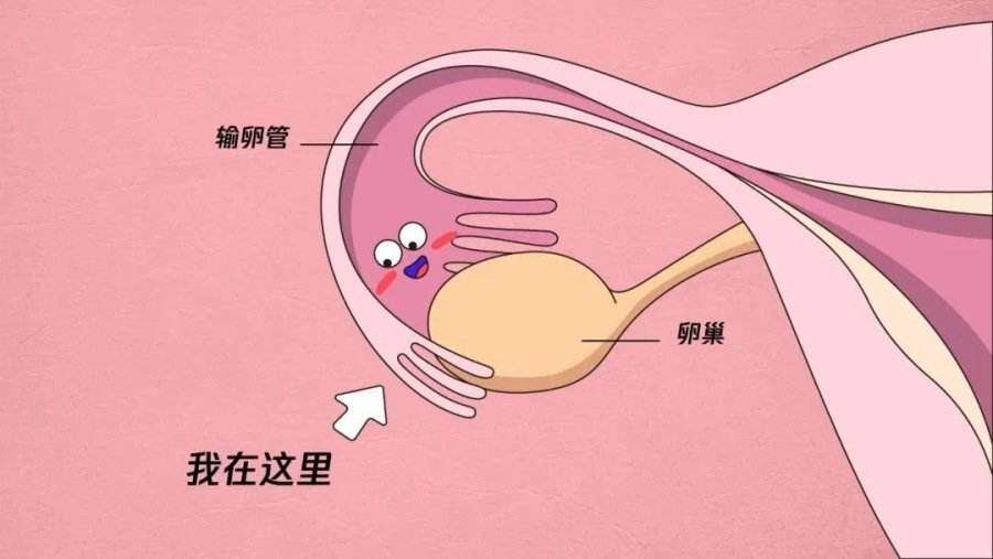 怎么会导致输卵管不通？造成输卵管堵塞的原因？