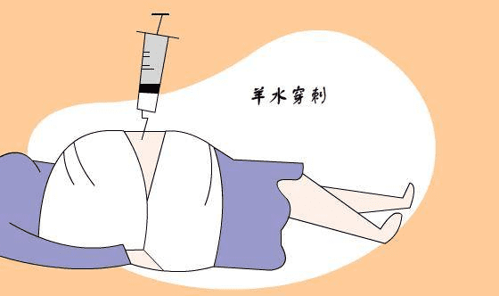 做完羊水穿刺后需要注意什么,羊水穿刺术后注意事项