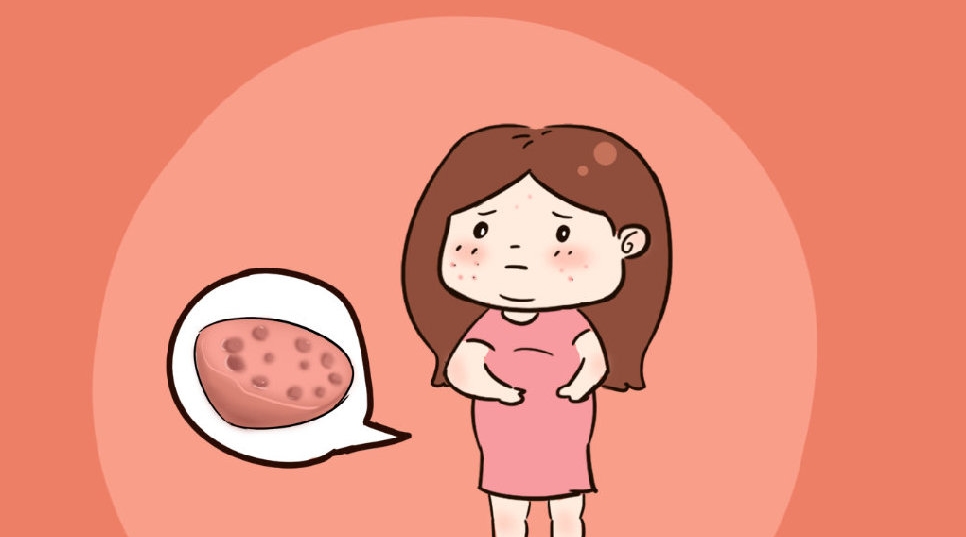 调经促孕丸在治疗多囊方面有效果吗？