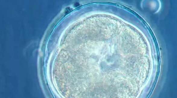 冻胚移植前怀孕几率探究，多因素综合考虑