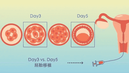 子宫内膜增厚刮宫疼吗？刮宫手术是什么感觉？
