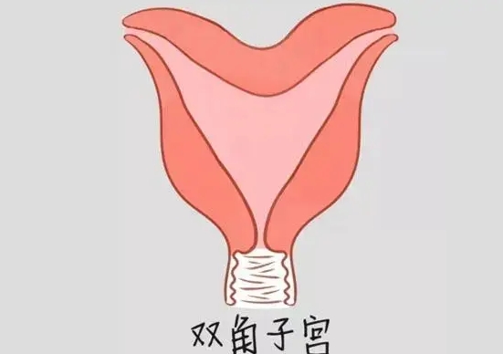 双角子宫怎么形成的？与这几点密不可分