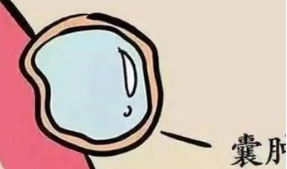 囊肿对试管成功率的影响分析，怎么做看这篇