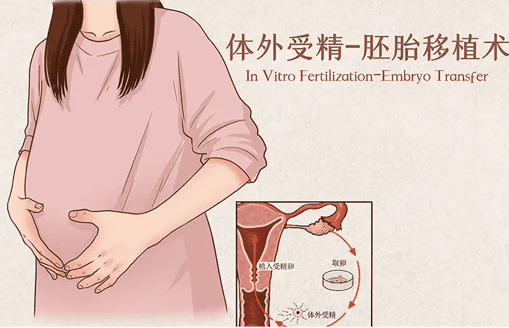 试管胚胎移植失败第二次收费吗？