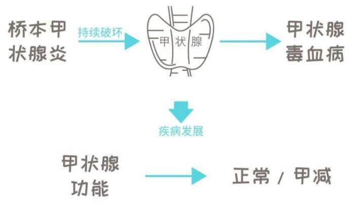 桥本甲状腺炎可以做试管婴儿吗？