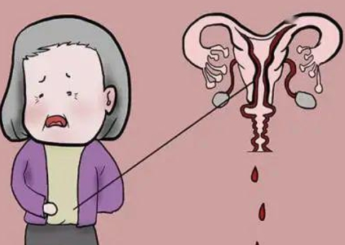 谁说绝经闭经不能做试管？高龄生育女性必看