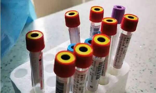 hpv18型DNA弱阳性能试管吗?试管前的禁忌症