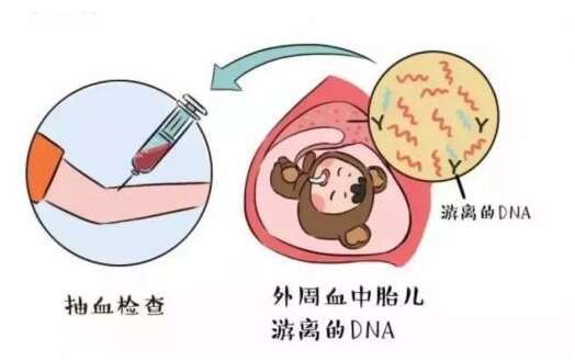 试管无创dna是不是容易高风险?试管做无创dna和唐筛的区别