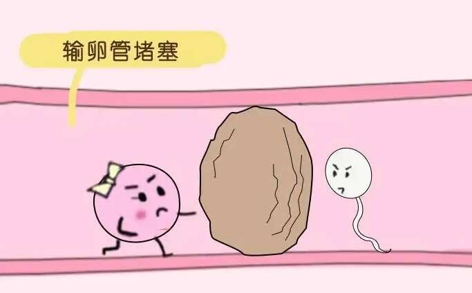 输卵管堵塞试管移植前需要疏通吗?达到条件后可以直接移植