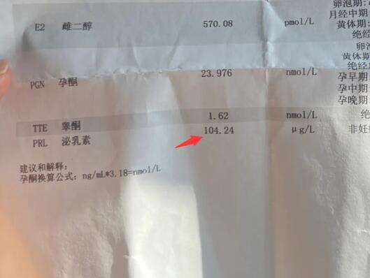 泌乳素高用这几种试管方案比较好，微刺激方案的药物量少
