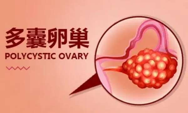 多囊试管促排不均匀正常吗?多囊试管促排依靠来曲唑