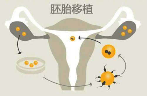提高试管婴儿成功率的方法有哪些?