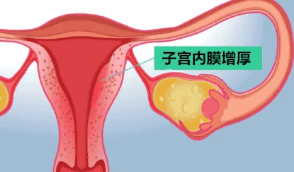 做试管不用打降调的情况有哪些?这些人群可以不用降调剂治疗