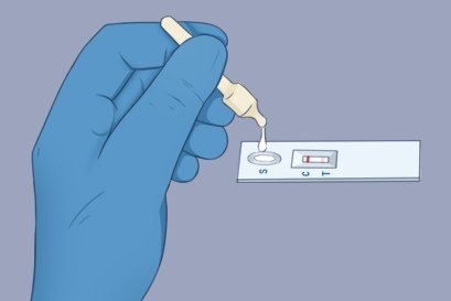 做试管梅毒滴度阴性可不可以?梅毒阴性的试管方案