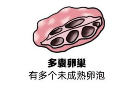 患有多囊的女性会正常的来月经吗？