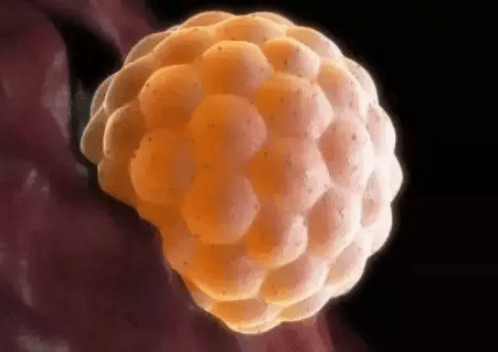 患有子宫疾病的女性选择囊胚移植的成功率有多少？
