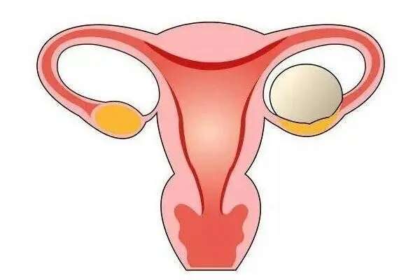 输卵管积水2cm国内哪家医院可以做供卵试管婴儿？