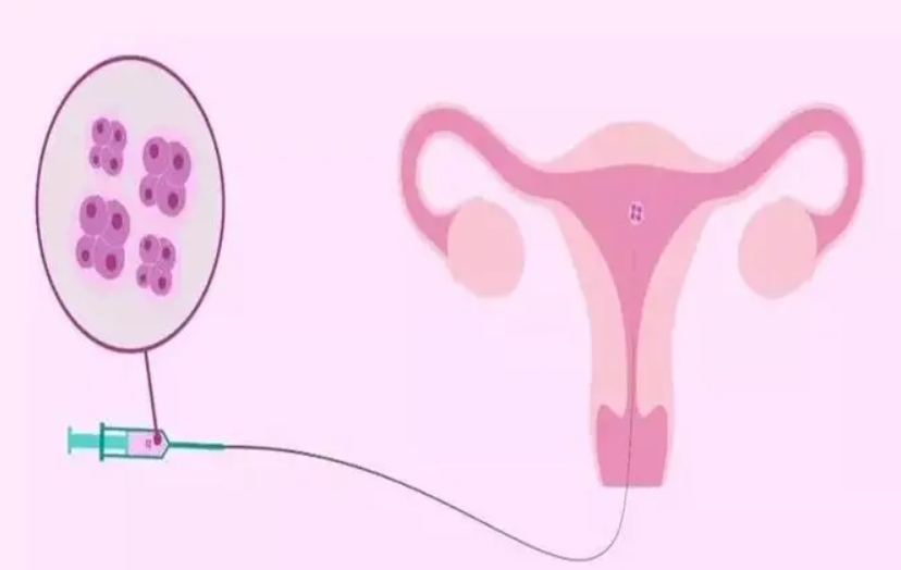 成都妇幼保健院做试管婴儿怎么样？成功率有多高？	