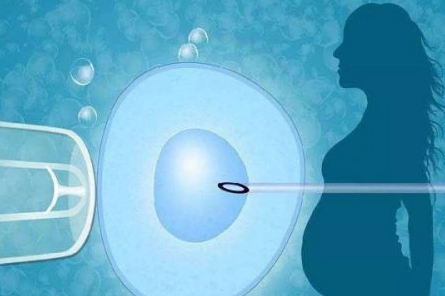 成都试管婴儿的费用是多少？可以报销吗？	