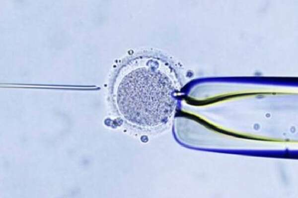 2024年做第三代试管婴儿要多少钱？试管婴儿技术有哪些优势？	