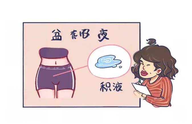 盆腔积液对做三代试管的影响有多大？影响胚胎移植吗？	