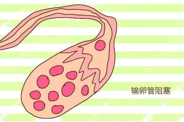 输卵管狭窄调理后再做试管能不能提高胚胎着床率？