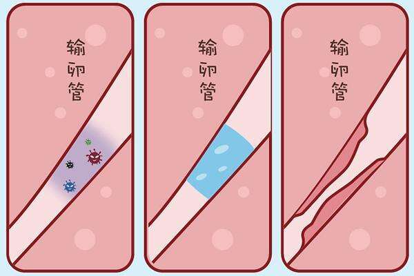 促排卵期间可以洗澡吗?	