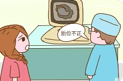 胎位不正