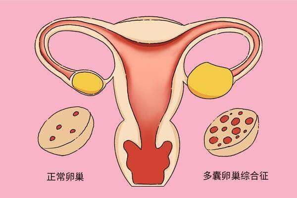精子顶体酶缺陷去俄罗斯做试管婴儿管用吗？