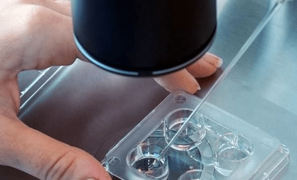 在成都做供卵试管婴儿需要多久？哪些因素影响成功率？
