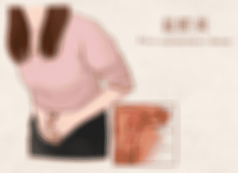 女性患有合并盆腔炎去俄罗斯做试管婴儿合适吗？