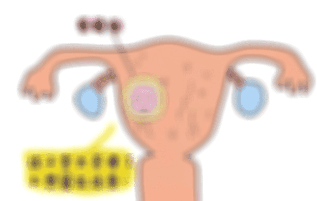 38岁宫腔环境不好可以做试管婴儿吗？如何提高成功率？