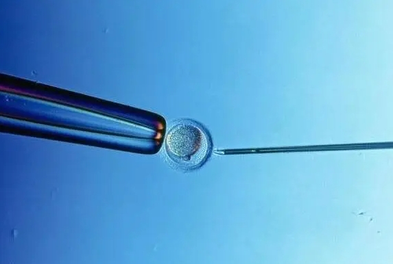 试管婴儿技术有缺点吗？做试管前需要慎重考虑