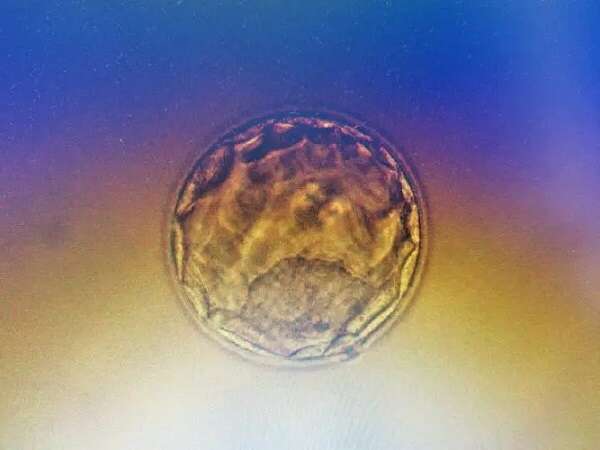 试管移植前内膜 14.2，为何令人担忧？