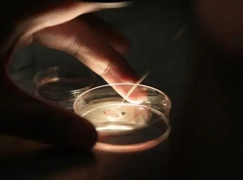 hiv患者可以去上海瑞金医院做试管婴儿吗？需要花费多少钱