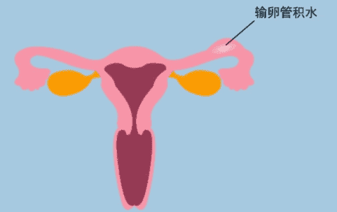 没有结婚证去广州做试管可以吗？流程是怎么样的