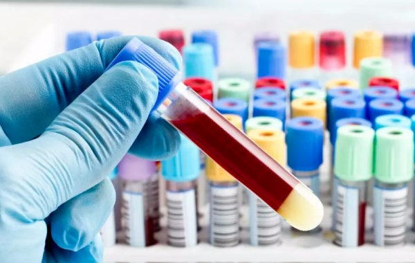 hiv患者去厦门做试管可以吗？流程是怎么样的