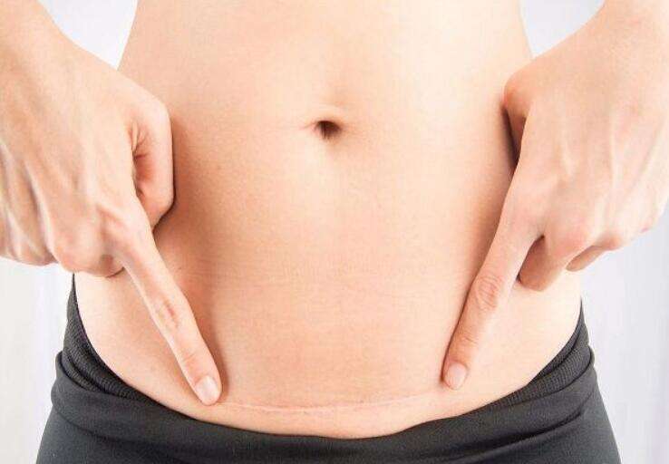 空腹粘连可以去广州做试管吗？大概需要花费多少钱