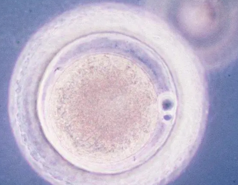 没有结婚证可以去浙江做试管吗？大概需要花费多少钱
