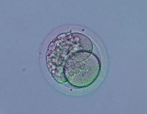 没有结婚证可以去福建做试管吗？大概需要花费多少钱