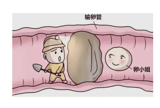 多囊可以去浙江做试管吗？大概需要花费多少钱