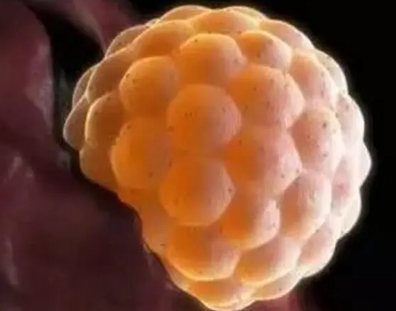 甲减去浙江做三代试管麻烦吗？需要花费多少钱